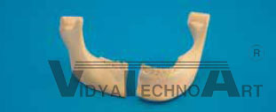 Mandible, fractured, Clip